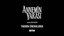 Annemin Yarası - Fragman görüntüsü