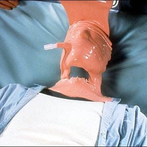 Fotoğraf Görünmeyen Tehlike