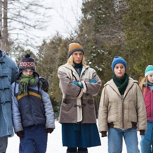 Fotoğraf Birthmarked