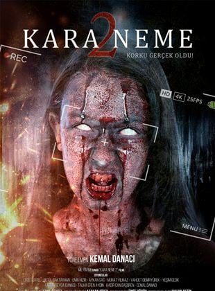 Kara Neme 2