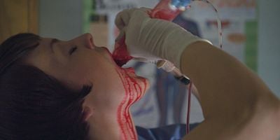 Blood Vessels posteri