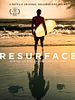 Resurface posteri