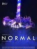 Normal posteri