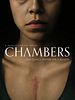 Chambers posteri